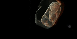Embarazo 3 meses propuesta por el ultrasonido Voluson E10. Foto cortesía de GE