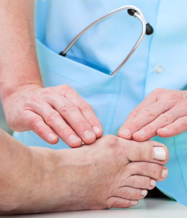 Sufres de juanetes Cirugía Mínima Invasiva